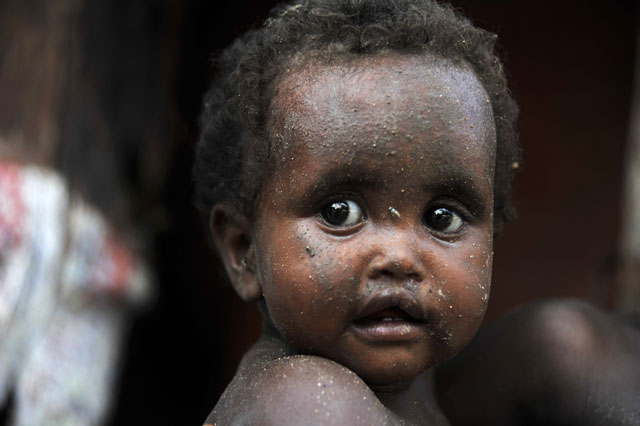 25IDPs Somalia